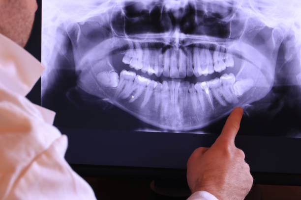 Best Pediatric Emergency Dentist in Redington Shores, FL